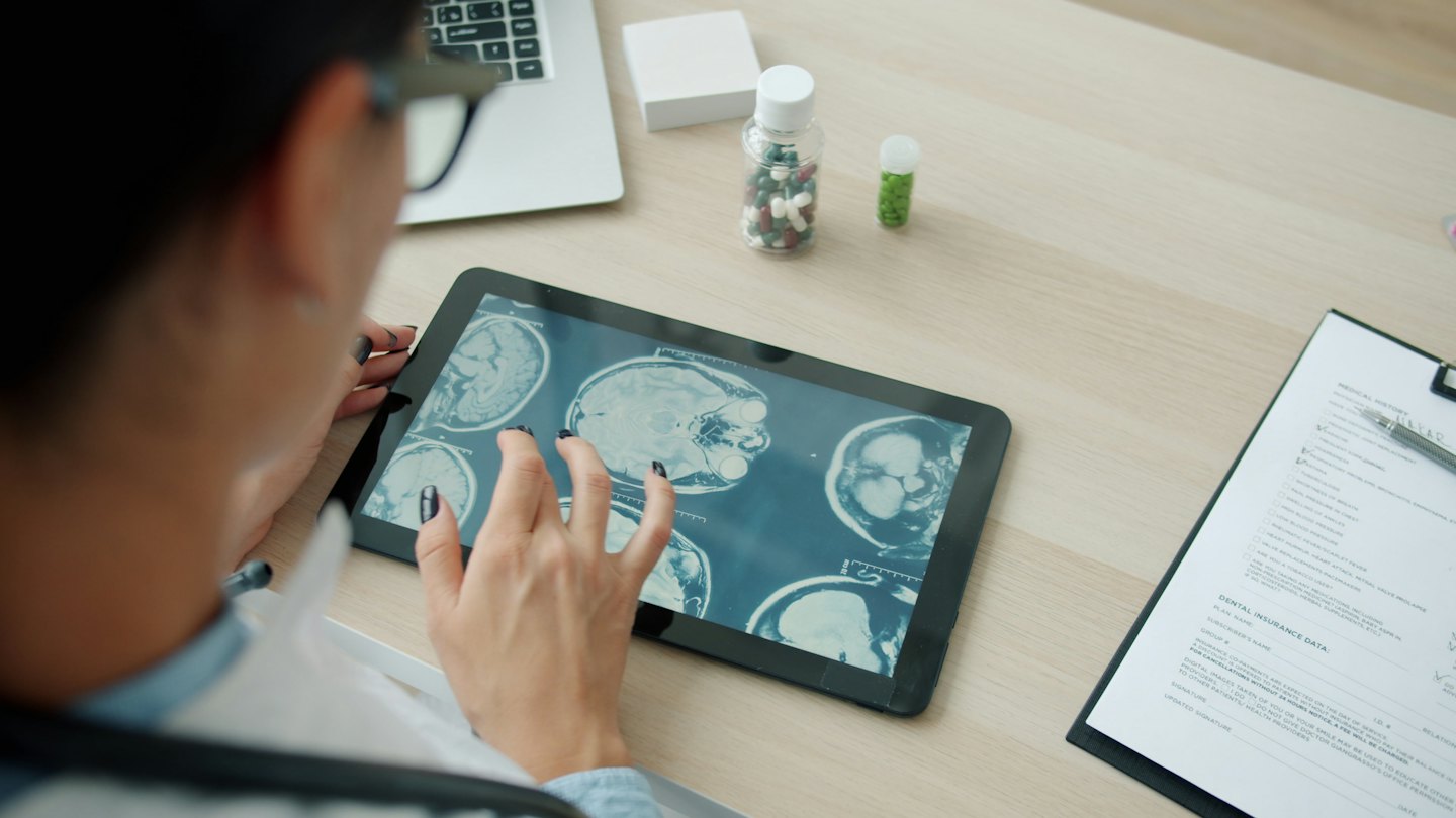 Médico revisando escáneres cerebrales en una tableta en un escritorio.